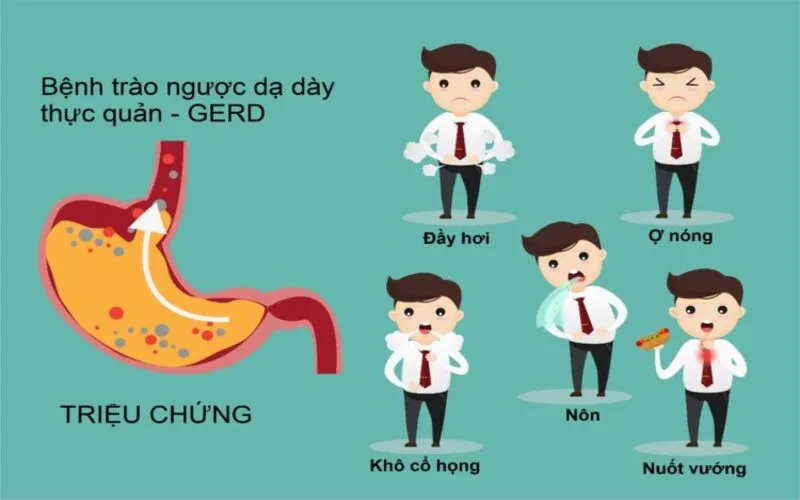 dau hieu trao nguoc da day va 6 bieu hien thuong gap